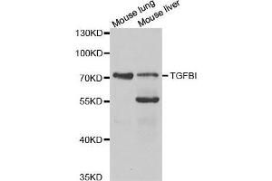 Western blot analysis of extracts of various cell lines, using TGFBI antibody. (TGFBI anticorps  (AA 481-683))