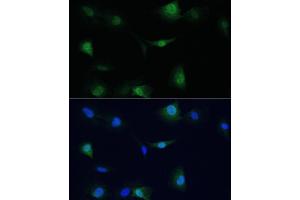 Immunofluorescence analysis of C6 cells using VCP antibody (ABIN6128632, ABIN6150072, ABIN6150073 and ABIN6217335) at dilution of 1:100. (VCP anticorps  (AA 647-806))