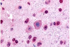 Mouse, Brain (formalin-fixed, paraffin-embedded) stained with GLI2 antibody ABIN214612 at 5 ug/ml followed by biotinylated goat anti-rabbit IgG secondary antibody ABIN481713, alkaline phosphatase-streptavidin and chromogen. (GLI2 anticorps  (Internal Region))