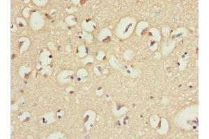 Immunohistochemistry of paraffin-embedded human brain tissue using ABIN7156852 at dilution of 1:100
