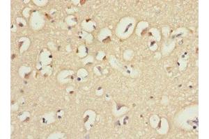 Immunohistochemistry of paraffin-embedded human brain tissue using ABIN7156852 at dilution of 1:100