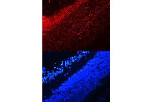Immunofluorescence (IF) image for anti-Interleukin 17A (IL17A) (AA 24-155) antibody (ABIN3021082)