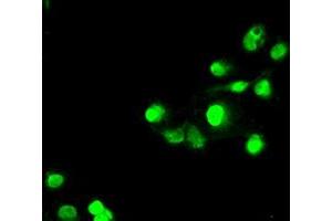 Anti-SATB1 mouse monoclonal antibody (ABIN2452372) immunofluorescent staining of COS7 cells transiently transfected by pCMV6-ENTRY SATB1 (RC200421). (SATB1 anticorps)