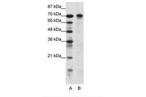 Image no. 1 for anti-Hypermethylated in Cancer 1 (HIC1) (AA 209-258) antibody (ABIN6736116) (HIC1 anticorps  (AA 209-258))