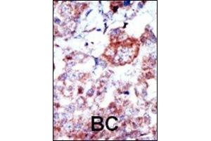 Image no. 3 for anti-Integrin-Linked Kinase (ILK) (AA 11-41) antibody (ABIN3031392) (ILK anticorps  (AA 11-41))