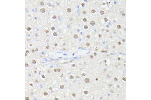 Immunohistochemistry of paraffin-embedded rat liver using MLF2 antibody (ABIN7268725) at dilution of 1:100 (40x lens). (MLF2 anticorps  (AA 1-65))