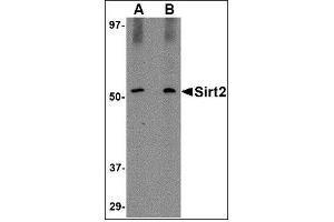 Western blot analysis of SIRT2 in Mouse brain lysate with SIRT2 antibody at (A) 1 and (B) 2 µg/ml.