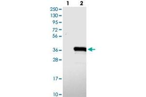 Western blot analysis of Lane 1: Negative control (vector only transfected HEK293T lysate), Lane 2: Over-expression Lysate (Co-expressed with a C-terminal myc-DDK tag (~3. (TYW3 anticorps)