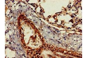 Immunohistochemistry of paraffin-embedded human lung tissue using ABIN7154420 at dilution of 1:100 (GZMK anticorps  (AA 27-264))