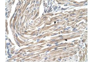 MGST2 antibody was used for immunohistochemistry at a concentration of 4-8 ug/ml to stain Skeletal muscle cells (arrows) in Human Muscle.
