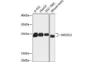 Western blot analysis of extracts of various cell lines, using MESDC2 antibody (ABIN6128279, ABIN6143742, ABIN6143744 and ABIN6218106) at 1:3000 dilution. (MESDC2 anticorps  (AA 1-234))
