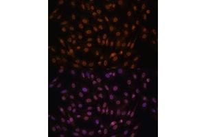 Immunofluorescence analysis of C6 cells using FCF1 antibody (ABIN7267162) at dilution of 1:100. (FCF1 anticorps)