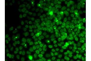 Immunofluorescence analysis of MCF7 cells using UFD1L antibody (ABIN1683208, ABIN5664259, ABIN5664261 and ABIN6220174).