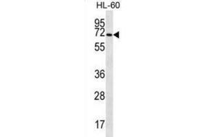 Western Blotting (WB) image for anti-Solute Carrier Family 6 (Amino Acid Transporter), Member 14 (Slc6a14) antibody (ABIN2997057) (Slc6a14 anticorps)