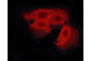 ABIN6267505 staining Hela cells by ICC/IF. (CASR anticorps  (pThr888))