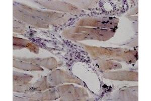 Expression of RyR1 in rat skeletal muscle - Immunohistochemical staining of paraffin embedded sections of rat quadriceps using Anti-Ryanodine Receptor 1 Antibody (ABIN7043604, ABIN7045211 and ABIN7045212), (1:100). (RYR1 anticorps  (Intracellular, N-Term))