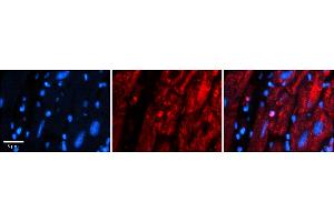 Rabbit Anti-MRPS15 Antibody    Formalin Fixed Paraffin Embedded Tissue: Human Adult heart  Observed Staining: Nuclear, Cytoplasmic Primary Antibody Concentration: 1:600 Secondary Antibody: Donkey anti-Rabbit-Cy2/3 Secondary Antibody Concentration: 1:200 Magnification: 20X Exposure Time: 0. (MRPS15 anticorps  (N-Term))