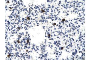 Rabbit Anti-VEZF1 antibody        Paraffin Embedded Tissue:  Human Lung cell   Cellular Data:  Epithelial cells of renal tubule  Antibody Concentration:   4.