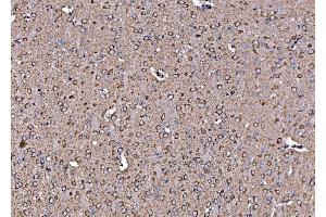 IHC analysis of DLAT using anti-DLAT antibody (ABIN7602307). (DLAT anticorps  (AA 69-642))