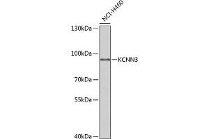 Western blot analysis of extracts of NCI-H460 cells, using KCNN3 antibody (ABIN6131840, ABIN6142769, ABIN6142771 and ABIN6221723) at 1:1000 dilution. (KCNN3 anticorps  (AA 237-426))