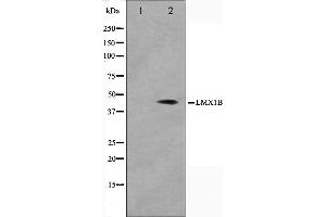 Western blot analysis on Jurkat cell lysate using LMX1B Antibody,The lane on the left is treated with the antigen-specific peptide. (LMX1B anticorps  (Internal Region))