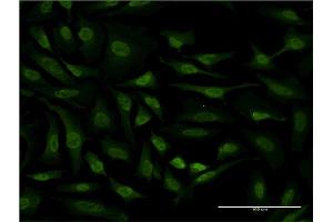 Immunofluorescence of monoclonal antibody to RPS6KA6 on HeLa cell. (RPS6KA6 anticorps  (AA 636-745))