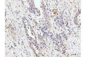 IHC analysis of Golgin 97/GOLGA1 using anti-Golgin 97/GOLGA1 antibody (ABIN7599539). (GOLGA1 anticorps  (AA 1-752))