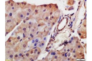 Formalin-fixed and paraffin embedded mouse pancreas labeled with Anti-HDAC8 Polyclonal Antibody, Unconjugated  at 1:200 followed by conjugation to the secondary antibody and DAB staining.