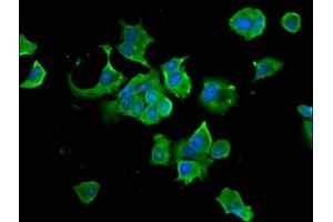Immunofluorescence staining of MCF-7 cells with ABIN7154923 at 1:66, counter-stained with DAPI. (HSP9AB1 (AA 150-355) anticorps)