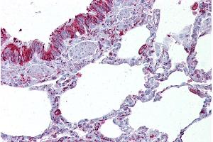 Immunohistochemistry with Lung tissue at an antibody concentration of 5µg/ml using anti-GABRB3 antibody (ARP35339_P050) (GABRB3 anticorps  (Middle Region))