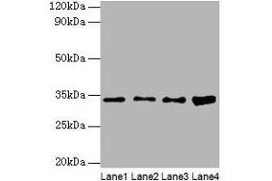 Western blot All lanes: GTF2E2 antibody at 2 μg/mL Lane 1: Mouse brain tissue Lane 2: Hela whole cell lysate Lane 3: MCF-7 whole cell lysate Lane 4: PC-3 whole cell lysate Secondary Goat polyclonal to rabbit IgG at 1/10000 dilution Predicted band size: 34 kDa Observed band size: 34 kDa (GTF2E2 anticorps  (AA 1-291))