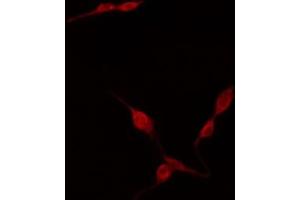 ABIN6274402 staining HuvEc by IF/ICC. (TNFAIP8L2 anticorps  (Internal Region))
