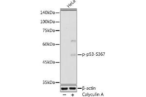 Western blot analysis of extracts of HeLa cells, using Phospho-p53-S367 antibody (ABIN7271087) at 1:500 dilution. (p53 anticorps  (pSer367))