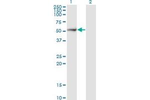 Western Blot analysis of PSMD5 expression in transfected 293T cell line by PSMD5 monoclonal antibody (M17), clone 1H7.