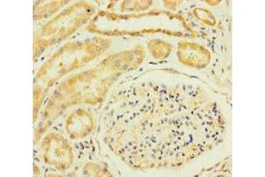 Immunohistochemistry of paraffin-embedded human kidney tissue using ABIN7172224 at dilution of 1:100 (TM2D3 anticorps  (AA 31-153))