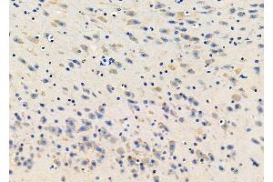 ABIN6265432 and ABIN6278417 at 1/100 staining Mouse brain tissue by IHC-P. (TACR2 anticorps  (C-Term))