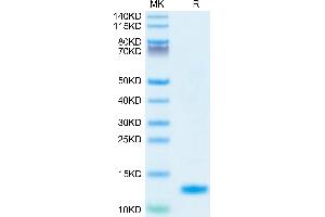 IL-8 Protein (AA 28-99) (His tag)