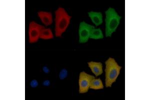 Desmin Mouse Monoclonal Antibody staining Hela cells by IF/ICC.