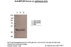 Image no. 2 for anti-Microtubule Associated Tumor Suppressor 1 (MTUS1) (N-Term) antibody (ABIN2781854) (MTUS1 anticorps  (N-Term))