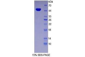 SDS-PAGE of Protein Standard from the Kit  (Highly purified E. (ENO2/NSE Kit ELISA)