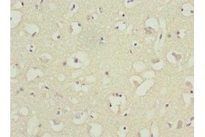 Immunohistochemistry of paraffin-embedded human brain tissue using ABIN7145556 at dilution of 1:100