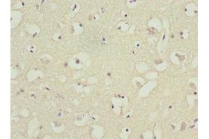 Immunohistochemistry of paraffin-embedded human brain tissue using ABIN7145556 at dilution of 1:100 (BFAR anticorps  (AA 1-140))