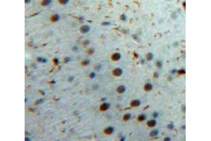 Used in DAB staining on fromalin fixed paraffin-embedded Brain tissue (IL-33 anticorps  (AA 1-270))