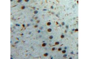 Used in DAB staining on fromalin fixed paraffin-embedded Brain tissue