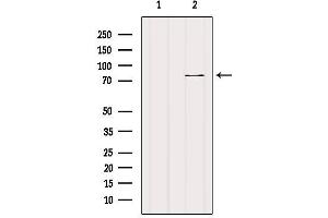 Western blot analysis of extracts from B16F10, using CPT1C-specific Antibody.