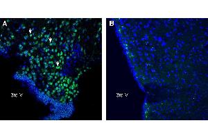 Expression of C3aR1 in mouse hypothalamus.