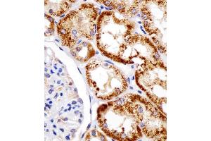 (ABIN390207 and ABIN2840690) staining DDIT4 in human kidney tissue sections by Immunohistochemistry (IHC-P - paraformaldehyde-fixed, paraffin-embedded sections). (DDIT4 anticorps  (N-Term))