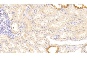 Detection of LAMb3 in Human Kidney Tissue using Polyclonal Antibody to Laminin Beta 3 (LAMb3)