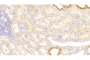 Detection of LAMb3 in Human Kidney Tissue using Polyclonal Antibody to Laminin Beta 3 (LAMb3) (Laminin beta 3 anticorps  (AA 352-587))