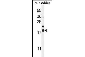 F162A Antibody (C-term) (ABIN654943 and ABIN2844584) western blot analysis in mouse bladder tissue lysates (35 μg/lane). (F162A anticorps  (C-Term))